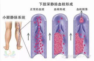 2d8812a64a6d1db25368a121d741cfa3.jpg